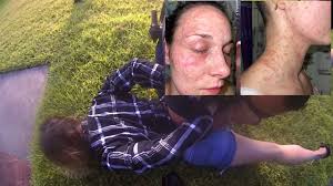 Galveston County Woman Files Lawsuit Alleging Excessive Force by Santa Fe Police